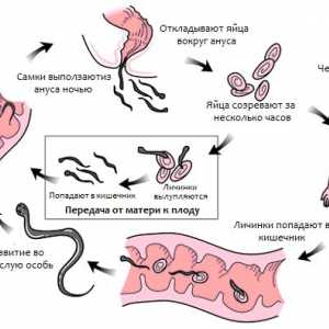 Чести инфекции (црв наезда) pinworms (enterobiasis) човек
