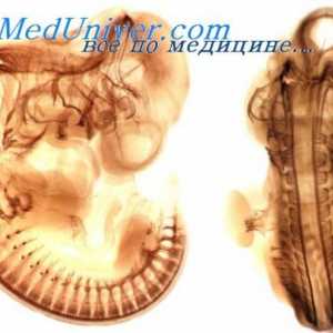 Феталната кранијални нерви. Развојот на кранијалните нерви на ембриони
