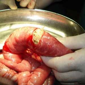 Кои јадат црви во човечкото тело, и како да се репродуцира