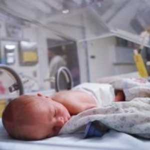 Дијафрагмална хернија дефекти кај новороденчињата