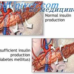 Дејството на инсулинот врз метаболизмот на јаглени хидрати. Размена на гликоза од страна на…