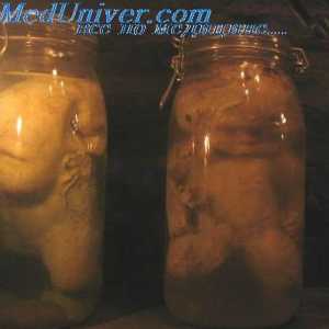 Формирање на ембрион се соочува. Надворешните гениталии на фетусот