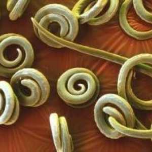 Паразитски наезда со pinworms: третман, симптомите