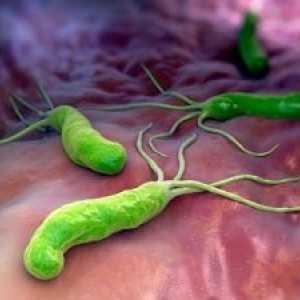 Инфекција на Helicobacter pylori: третман, симптоми, причини, дијагноза, симптомите