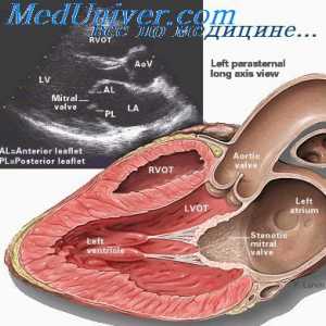 Хемодинамски нарушувања во срцеви мани, и физички напор