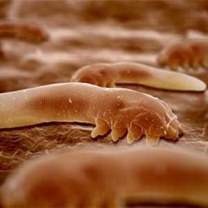 Како црви влијае на човечкото тело?