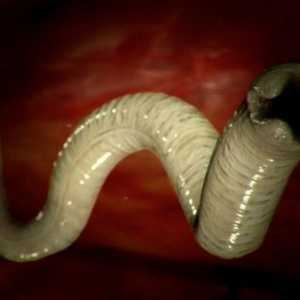Кои се димензиите на црви (хелминти) кај луѓето?