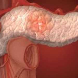 Цистична тумори на панкреасот