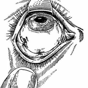 Третман на фази на медицинска евакуација со лезии на орган на визија. Третман на повреди на очите и