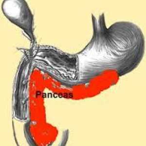 Третман на панкреатит (на панкреасот) во акутна фаза