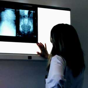 Третман во Шпанија дијагностички центар слики д-р manchon Барселона