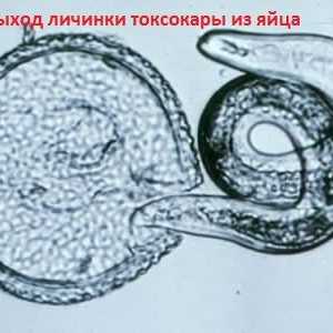 Ларви и јајца Toxocara висцерална токсокаријаза