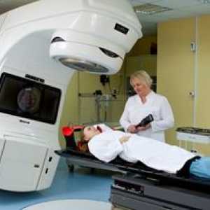 Радиотерапија и насочени терапија во рак на желудник