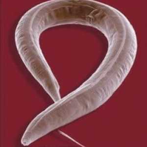 Мали, долги бели црви во возрасни и деца