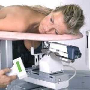 Мамографија дојка кога правам?