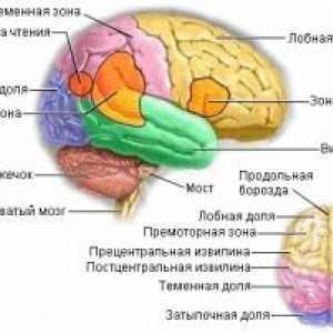 Метастатски тумори на мозокот