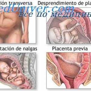 Механизми на почетокот на породувањето. Хормони влијаат на матката