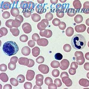 Уништувањето на хемоглобинот. различни анемија