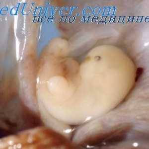 FIELD нозе фетусот мозокот. Epithalamus феталниот развој