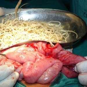 Операција за отстранување на црви, како да се отстрани хелминти?