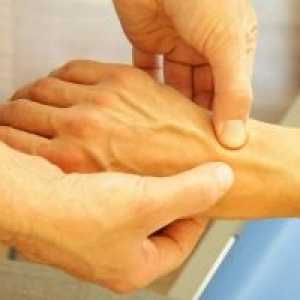 Остеоартритис на рачниот зглоб: Третман, Причини, Симптоми, знаци