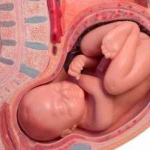 Плацентарна абрупција време на бременоста: симптоми, причини, третман, симптомите, компликации