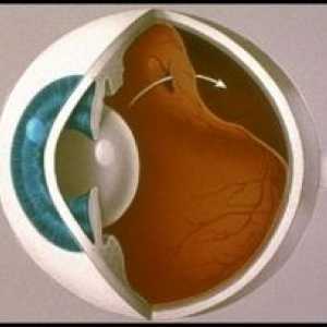 Ретинална аблација очи: причините, симптомите, третман, симптомите