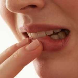 Сквамозен карцином на усната шуплина: третман, симптомите, прогнозата