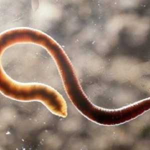 Зошто често (постојано) црви се појавуваат кај возрасни и деца?