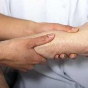 Оштетување на зглобовите во ревматски заболувања