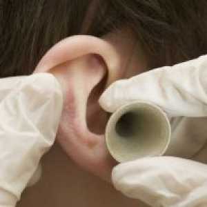 Пораз уво: кога примаат лекови со херпес зостер