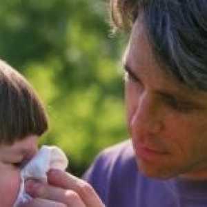Настинка кај децата симптоми, причини, третман, што да се прави ако детето има студ
