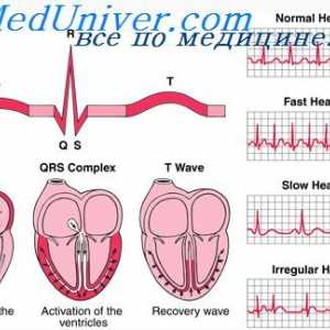 Срцевиот циклус. Порака електрокардиограм и срцевиот циклус