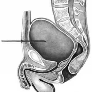 Пункција на мочниот меур
