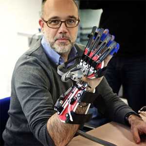 Роботска ракавица за рехабилитација мозочен удар