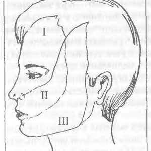 Улогата на тригеминалниот нерв во болка на лицето