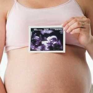 Широк карлицата на бремени жени
