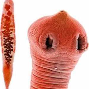 Симптоми црви (хелминти) и жолчката канали