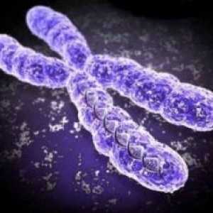 Синдром на фрагилниот X хромозом кај деца