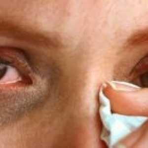 Солзење на очите: третман, причини, симптоми, знаци