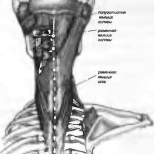 Болки во грбот предизвикани од страна на мускулите појас