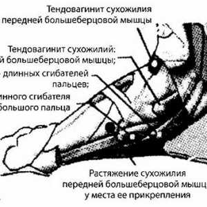 Нозете, глуждовите и долната третина на зрачење тибија и дијагностика инструмент