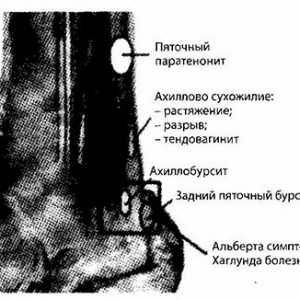 Нозете, глуждовите и долната третина на тибија зрачење и инструмент дијагностика. Патологијата на…