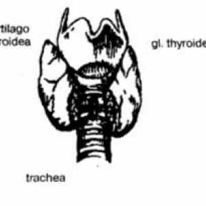 Трахеостомија