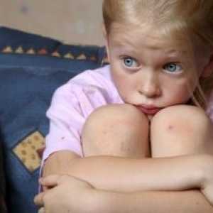 Анксиозни нарушувања кај децата: Третман, Симптоми, Причини