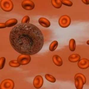 Тромбоцитите нарушувања: хемостаза, може да се идентификуваат?