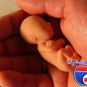 На темпорална коска на ембрионот. виличните коски на фетусот